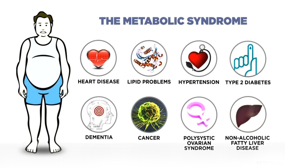 symptoms-metabolic-syndrome-obesity-high-blood-pressure-glucose-intolerance-high-cholesterol-Orlando